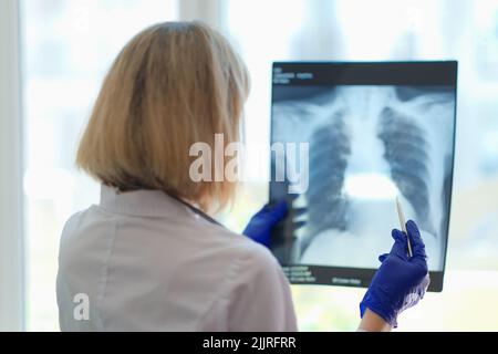 Arzt Pneumologe untersucht Röntgenaufnahme der Lunge Stockfoto