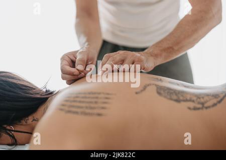 Hintergrundbeleuchtung des Therapeuten, der Akupunkturnadeln in den Rücken einer Frau klebte Stockfoto