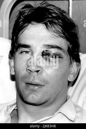 PORTSMOUTH-TORWART ALAN KNIGHT NACH DEM SPIEL IN WIMBLEDON IM KRANKENHAUS. PIC MIKE WALKER 2003 Stockfoto