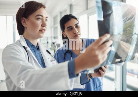 Zwei junge Ärzte kontrollieren Exrays in einem Krankenhaus. Stockfoto