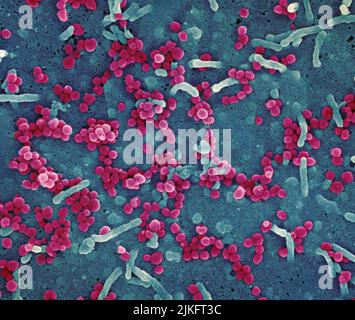 Rasterelektronenmikroskopische Aufnahme eines Lassa-Virus, das aus einer Zelle aufkeimend ist. Das Lassa-Virus (LASV) ist ein Arenavirus, das bei Menschen und anderen Primaten das Lassa-hämorrhagische Fieber, eine Art virales hämorrhagisches Fieber (VHF), verursacht. Bild angefordert von der NIAID Integrated Research Facility (IRF) in Fort Detrick, Maryland. Kredit: NIAID Stockfoto