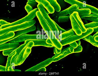 Rasterelektronenmikrographie des Bakteriums Mycobacterium tuberculosis, das Tuberkulose verursacht. Kredit: NIAID Stockfoto