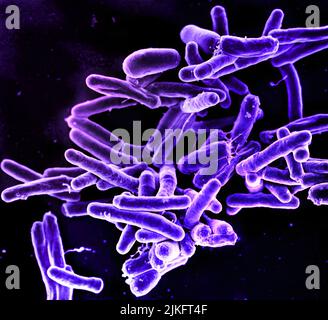Rasterelektronenmikrographie des Bakteriums Mycobacterium tuberculosis, das Tuberkulose verursacht. Kredit: NIAID Stockfoto