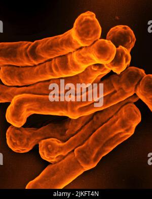 Rasterelektronenmikrographie des Bakteriums Mycobacterium tuberculosis, das Tuberkulose verursacht. Kredit: NIAID Stockfoto