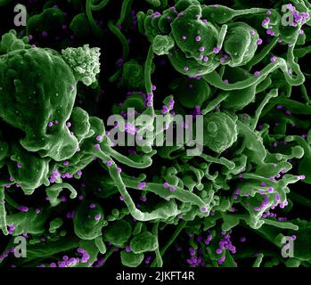 Rasterelektronenmikroskopische Aufnahme eines Lassa-Virus, das aus einer Zelle aufkeimend ist. Das Lassa-Virus (LASV) ist ein Arenavirus, das bei Menschen und anderen Primaten das Lassa-hämorrhagische Fieber, eine Art virales hämorrhagisches Fieber (VHF), verursacht. Bild gekauft und eingefärbt von der NIAID Integrated Research Facility (IRF) in Fort Detrick, Maryland. Kredit: NIAID Stockfoto