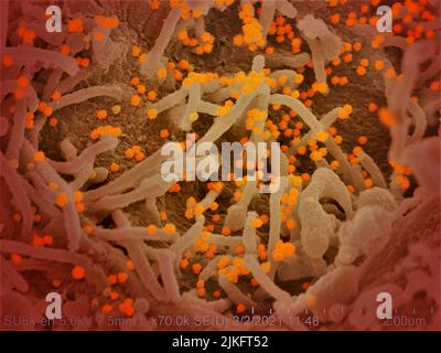 Dieses Rasterelektronenmikroskop-Bild zeigt SARS-CoV-2 (runde orangefarbene Partikel), die aus der Oberfläche einer im Labor kultivierten Zelle hervorgehen. SARS-CoV-2, auch bekannt als 2019-nCoV, ist das Virus, das COVID-19 verursacht. Aufnahme und Farbgebung in den Rocky Mountain Laboratories in Hamilton, Montana. Kredit: NIAID Stockfoto