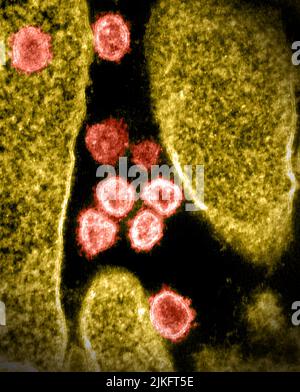 Dieses Transmissions-Elektronenmikroskop-Bild zeigt SARS-CoV-2, auch bekannt als 2019-nCoV, das Virus, das COVID-19 verursacht. Viruspartikel entstehen aus der Oberfläche einer im Labor kultivierten Zelle. Spitzen am äußeren Rand von Viruspartikeln geben Coronaviren ihren Namen, geformt wie eine Krone. Aufnahme und Farbgebung in den Rocky Mountain Laboratories in Hamilton, Montana. Kredit: NIAID Stockfoto