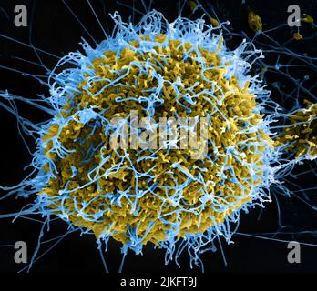 Eingefärbte Rasterelektronenmikroskopie von Ebola-Virus-Filamentpartikeln (blau), die aus einer chronisch infizierten VERO E6-Zelle (gelb-grün) aufkeimt. Stockfoto