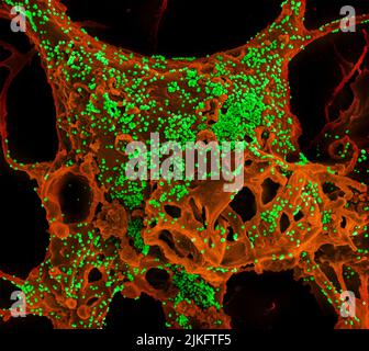 Farbverstärkter Rasterelektronenmikrograph von Vero E6-Zellen, die mit dem Coronavirus (MERS-CoV) des Middle East Respiratory Syndrome infiziert sind. Stockfoto