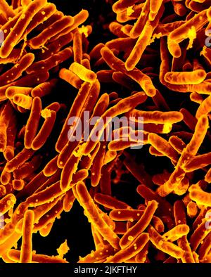 Rasterelektronenmikrographie des Bakteriums Mycobacterium tuberculosis, das Tuberkulose verursacht. Stockfoto