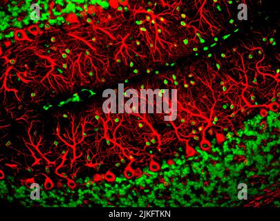 Dieses Bild zeigt Purkinje-Zellen, eine der wichtigsten Arten von Nervenzellen im Gehirn. Diese Zellen haben verzweigte Strukturen, die als Dendriten bezeichnet werden und Signale von anderen Nervenzellen empfangen. Stockfoto