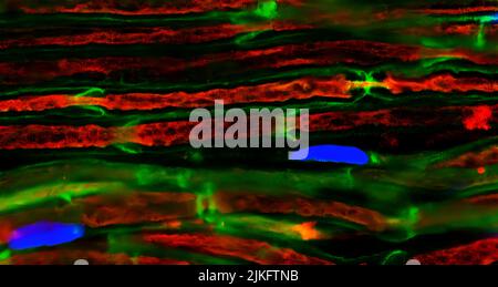 Mikroskopiebild von Mausiasnerven mit Axonen (rot), die von Schwann-Zellen umhüllt sind (grün) und deren Kerne blau dargestellt sind. Stockfoto