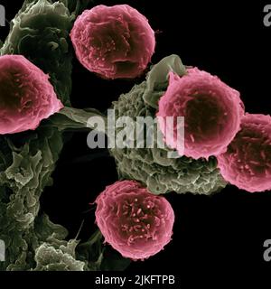 Forscher des Texas Center for Cancer Nanomedicine (TCCN) haben partikelbasierte Impfstoffe zur Behandlung von Krebs entwickelt. Die Partikel tragen Moleküle, die Immunzellen stimulieren, und Krebsantigene (Proteine), die die Immunantwort lenken. Dieses Rasterelektronenmikroskop-Bild zeigt dendritische Zellen, pseudogefärbt grün, in Wechselwirkung mit T-Zellen, pseudogefärbt rosa. Dendritische Zellen internalisieren Partikel, provozieren Antigene und präsentieren Peptide zu T-Zellen, um Immunantworten zu leiten. Stockfoto