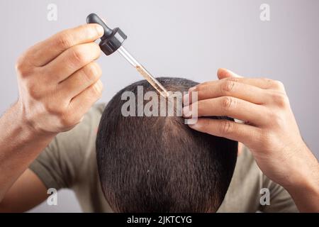 Minoxidil-Öl, weißer Hintergrund junge kaukasische Männchen tragen ätherisches Öl auf der Haut durch eine Pipette auf. Stockfoto