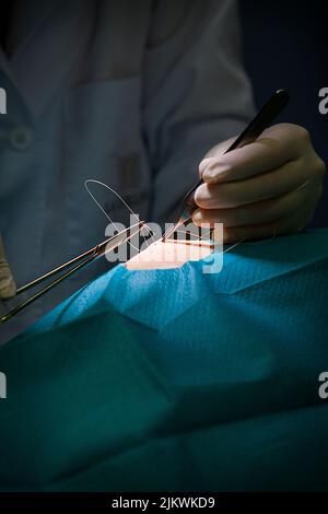 Stiche nach Entfernung einer Zyste durch den Dermatologen. Stockfoto