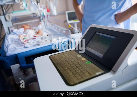 Ein frühes Neugeborenes mit anormalen Herzrhythmen hat ein EKG. Stockfoto