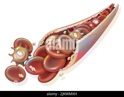 Zusammensetzung des Blutes (Blutkapillare): Rote Blutkörperchen, weiße Blutkörperchen. Stockfoto