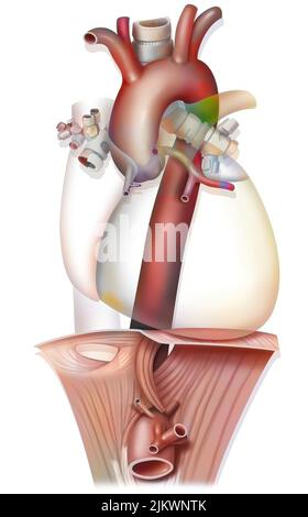 Anatomie der thorakalen Aorta, die das Zwerchfellmembran kreuzt. Stockfoto