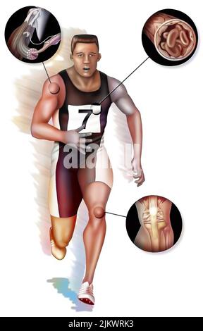 Sportler in der Anstrengung mit Zoom auf die Organe stimuliert im Falle von Doping. Stockfoto