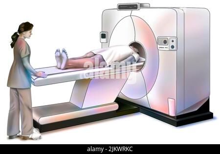 PET-Scan: Medizinisches Bildgebungsgerät zum Nachweis von Tumoren und Metastasen. Stockfoto