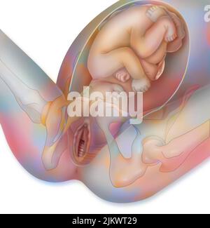 Geburt, Stadium 1: Das Baby ist im Becken beschäftigt. Stockfoto