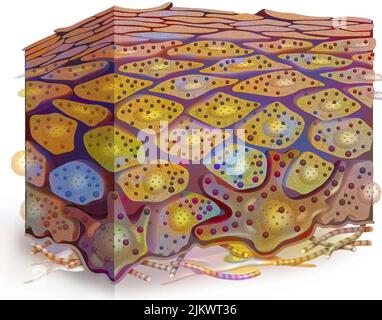 Querschnitt der Epidermis einer dunklen phototypischen Haut mit vielen Melaninkörnern. Stockfoto