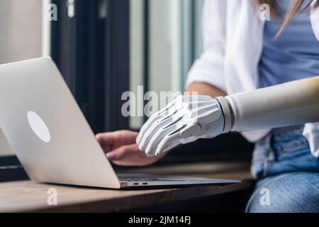 Motivierte Frau mit prothetischen Arm arbeiten Notebook-Computer, Text eingeben, Mädchen mit Behinderung führt normales Leben künstliche Prothese Extremität, Menschen Stockfoto