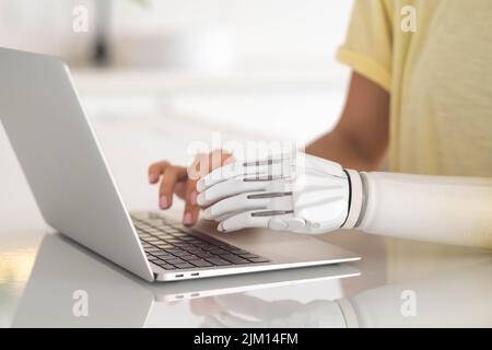 Motivierte Frau mit prothetischen Arm arbeiten Notebook-Computer, Text eingeben, Mädchen mit Behinderung führt normales Leben künstliche Prothese Extremität, Menschen Stockfoto