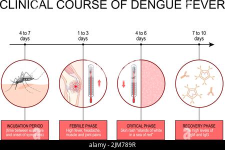 Dengue-Fieber. Infografiken zu klinischen Kursen. Von der Inkubationszeit bis zur fieberhaften Phase und Erholungsphase. Vektorgrafik. Poster zur Sensibilisierung Stock Vektor