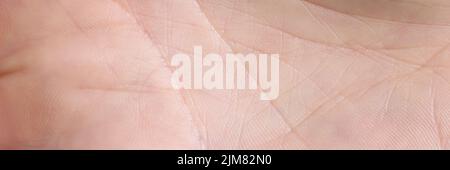 Nahaufnahme einer Makrolinie auf einem weißen Handarm Stockfoto