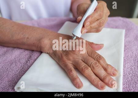 Eine ältere Frau trägt Heilcreme für Arthritis auf ihre alten Hände, Medizin Stockfoto