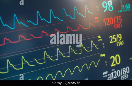 Monitor Herzfrequenz Beat Stockfoto