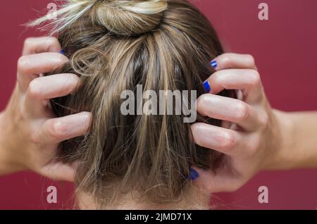 Tolles Konzept der Allergie und Hautkrankheiten, junge Frau ihren Kopf kratzen. Stockfoto