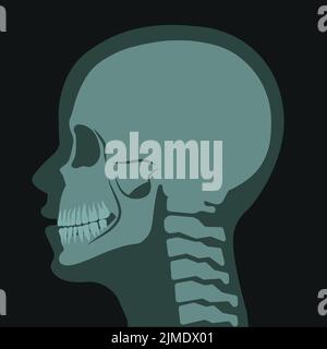 Röntgenaufnahme des Schädels, Scan für Diagnose und Behandlung Stock Vektor