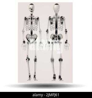 Röntgendarstellung eines menschlichen Skeletts Stockfoto