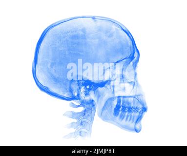 Menschlicher Schädel. Blaues Röntgenbild auf weißem Hintergrund Stockfoto
