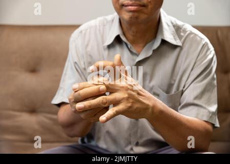 Ältere Männer, die an Gelenkschmerzen mit Gicht-Entzündung leiden Stockfoto