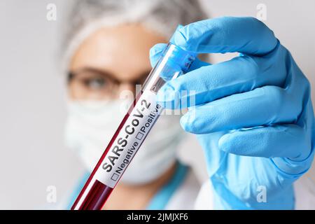 Eine Ärztin hält eine Blutprobe des SARS-CoV-2 in der Hand Stockfoto