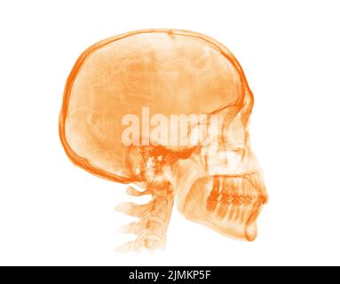 Menschlicher Schädel. Orangefarbenes Röntgenbild auf weißem Hintergrund Stockfoto