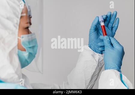Seitenansicht Arzt hält Blutprobe Stockfoto