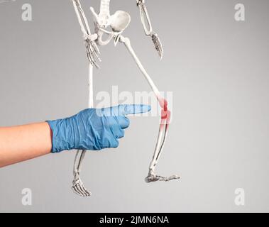 Arzthandel zeigt auf das Skelett-Knie mit rotem Punkt. Beinschmerzen. Verstauchte Bänder, Meniskusriss, Sehnenentzündung, Arthritis. Skelettsystem und Stockfoto