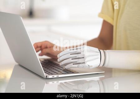 Motivierte Frau mit prothetischen Arm arbeiten oder lernen Notebook-Computer, Mädchen mit Behinderung Text eingeben künstliche Prothese Extremität. Stockfoto