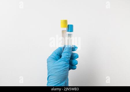 Vakuumröhrchen für die Entnahme und Blutproben in blauen Handschuhen für das Labor. Auf weißem Hintergrund Stockfoto