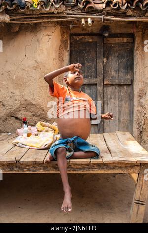 Prominente Abdominaldehnung in Südost-delhi, indischer Mann. Ein aufgeblähter Abdomen kann durch Aszites mit Zirrhose, Darmverschluss oder Fett verursacht werden. Stockfoto