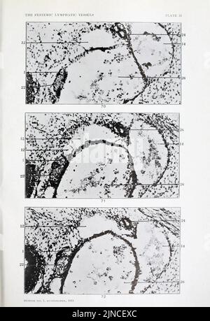 Die Anatomie und Entwicklung der systemischen Lymphgefäße bei der Hauskatze Stockfoto