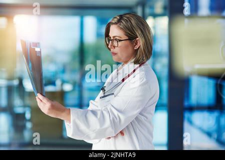 Shes konzentrierte sich auf die Suche nach einem geeigneten Behandlungsverfahren. Ein Arzt, der eine Röntgenaufnahme in einem Krankenhaus analysiert. Stockfoto