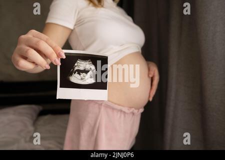 Eine Schwangere demonstriert ihr Ultraschallfoto, während sie im Schlafzimmer steht. Bild mit Ultraschall-Scan Ergebnis im Fokus. Stockfoto