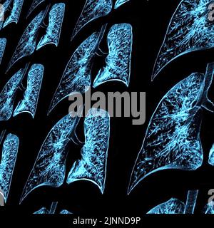 Lunge, CT-Scan Stockfoto