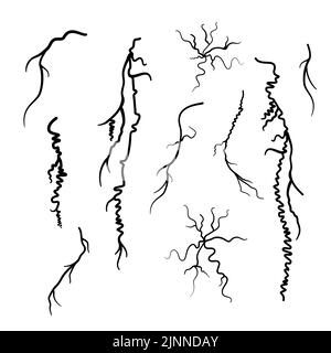 Krampfadern, Illustration Stockfoto