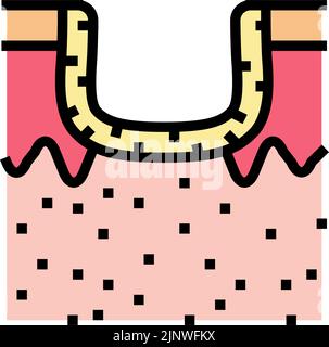 Hypertrophe Akne Narbe Farbe Symbol Vektor Illustration Stock Vektor